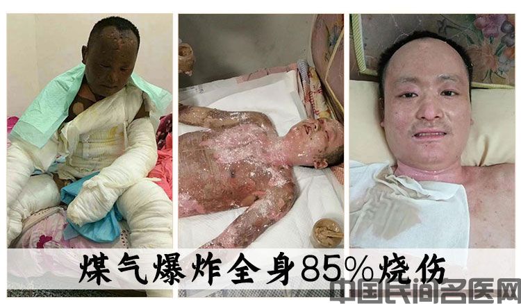 陈天鹏-案例图片1.jpg