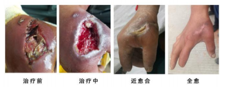当代名医 — 黄静湖