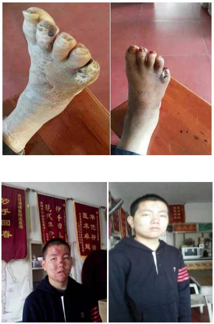连氏中医第十一代传承人——连正福