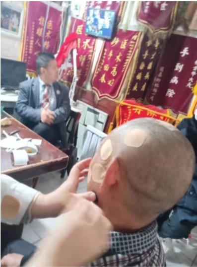 光明天使 济世良医 聊城德医堂头痛病研究所——崔金金医师