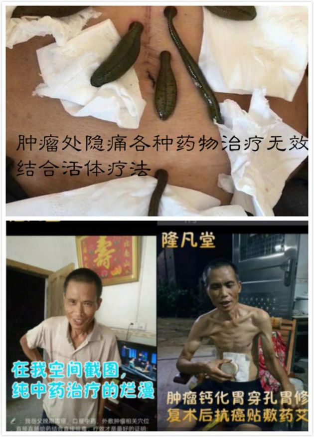 中医国粹人物专题报道---中医肿瘤专家周崇立七代祖传中医