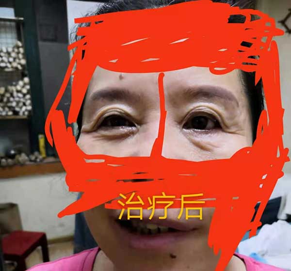 当代针刀医学传承人 — 孟德林