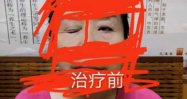 当代针刀医学传承人 — 孟德林